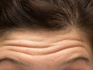 why does skin wrinkle when it is exposed at length to water